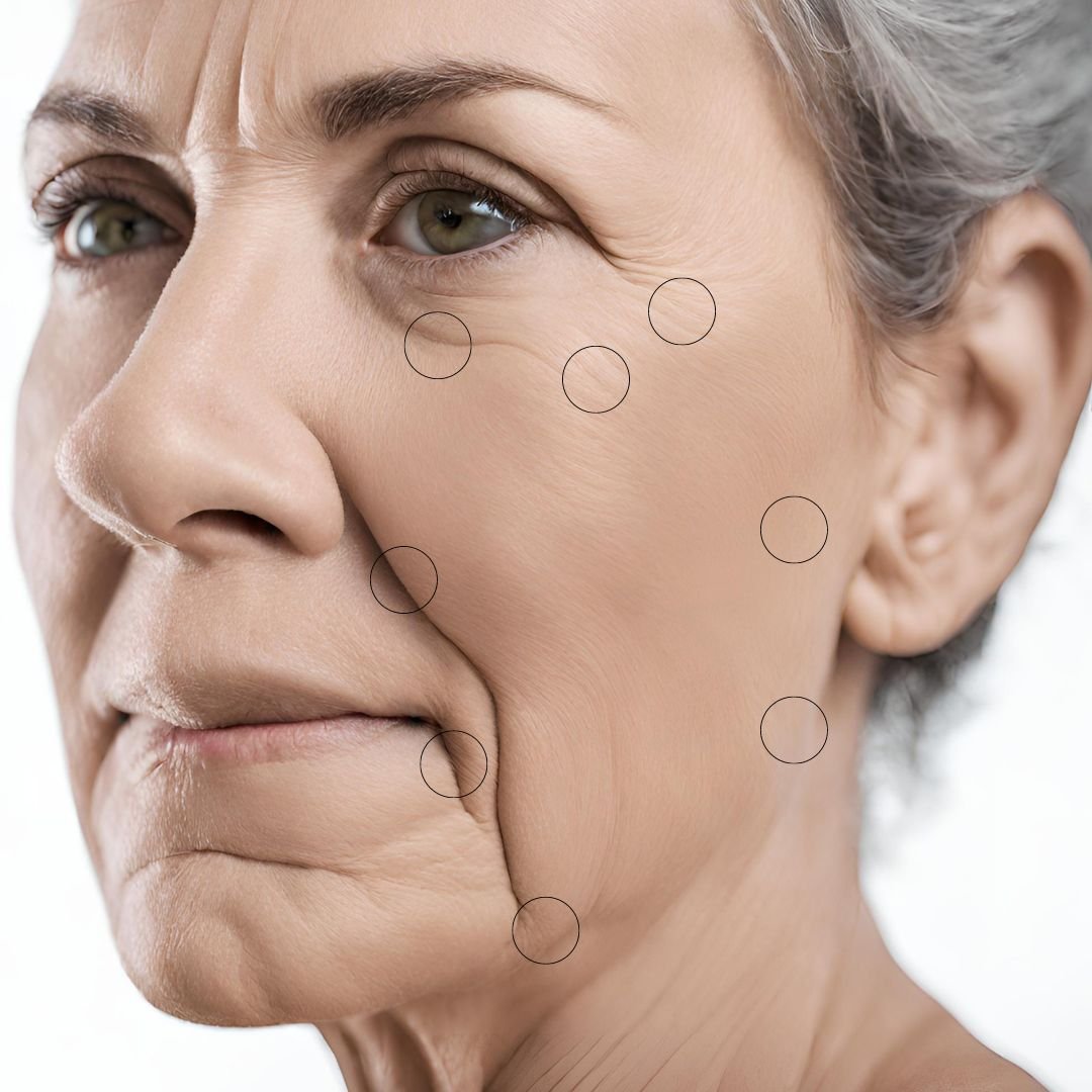 8 point facelift helsinki vantaa