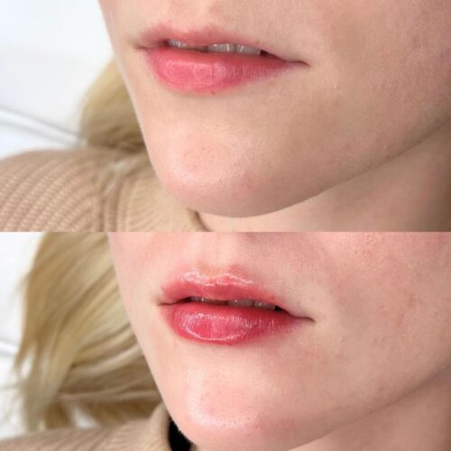 Huulten muotoilu 055 ml