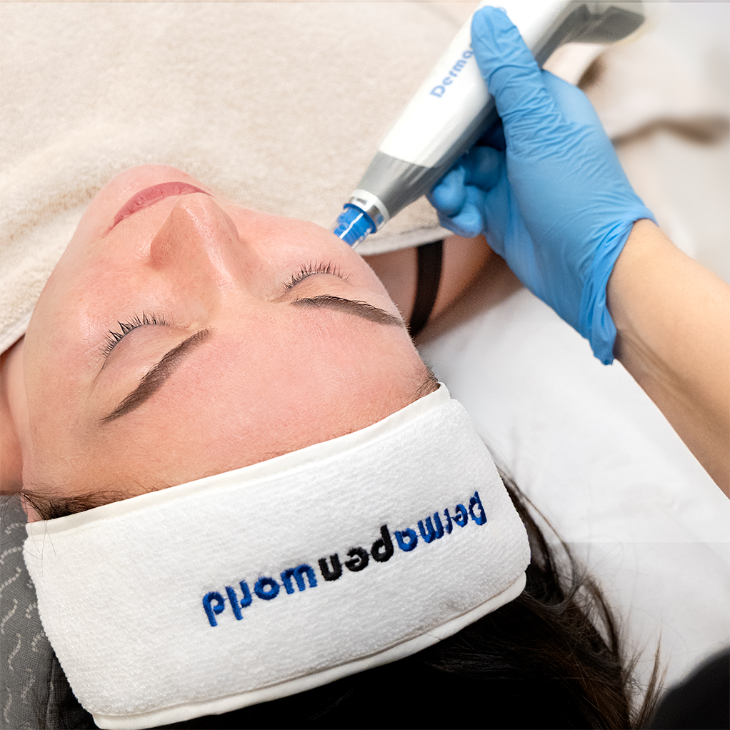 Mikroneulaus Ebeling Kauneus Helsinki Vantaa Tikkurila Kalasatama esteettiset hoidot