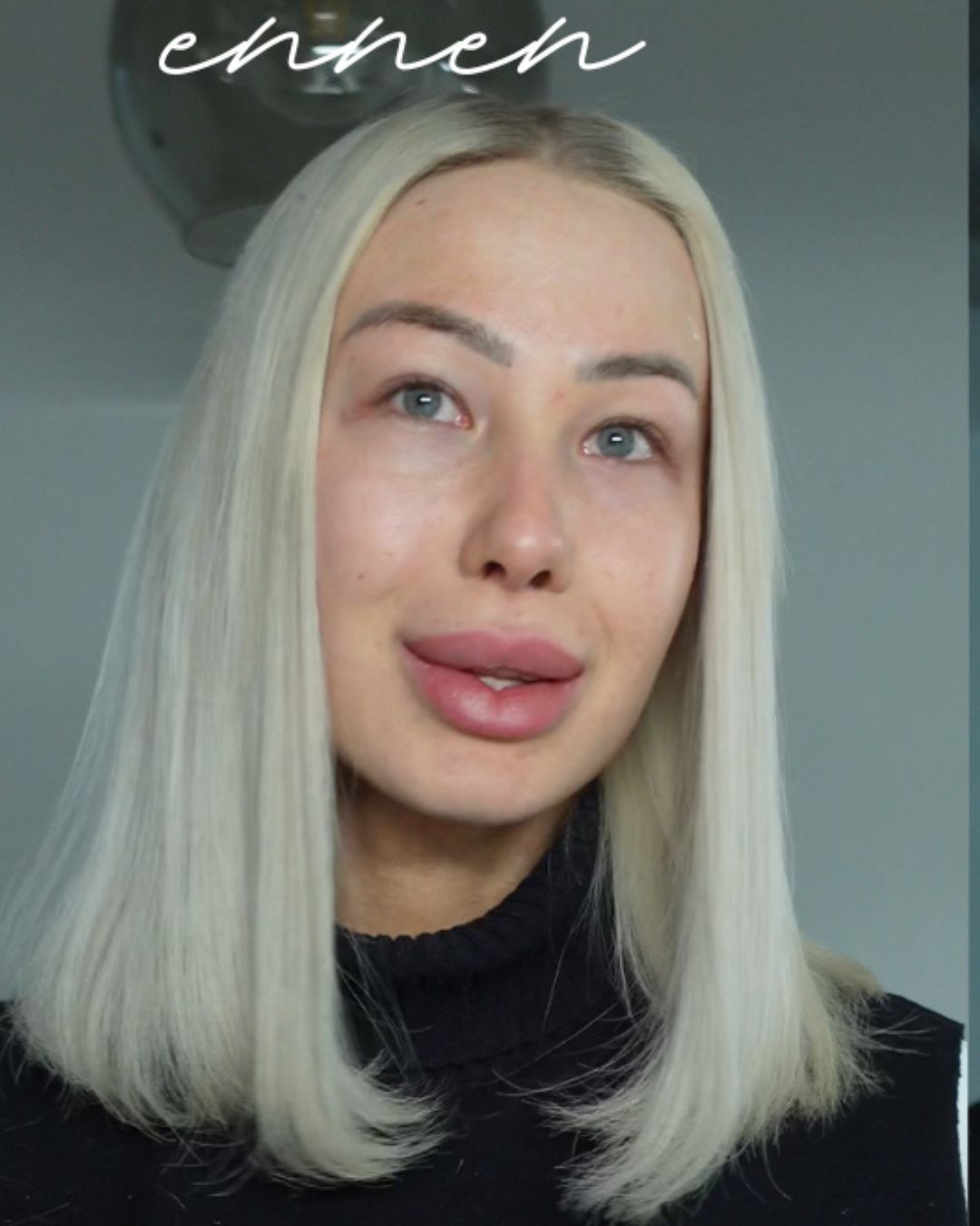 Täyteaineen poisto ennen 