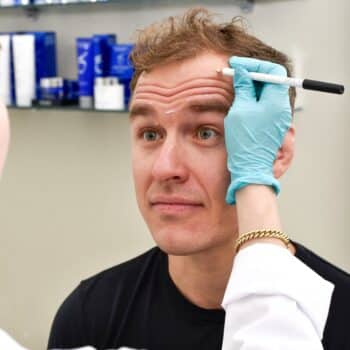 Brotox, eli miesten botox