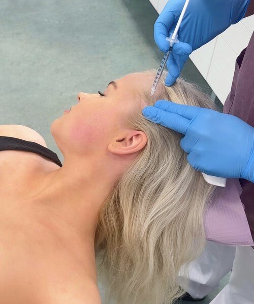 botox puremalihaksiin botuliinihoito