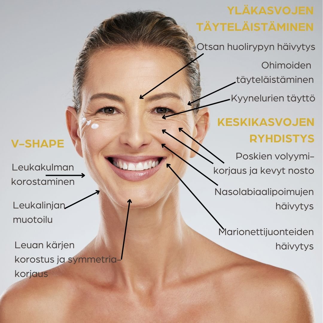 full face täyteainehoito