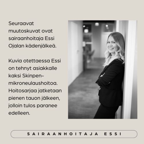 Essi Ojala kokemuksia (1)
